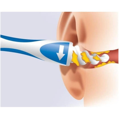 Aparat za čiste uši