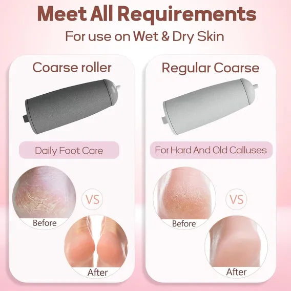 Električna turpija – za stopala